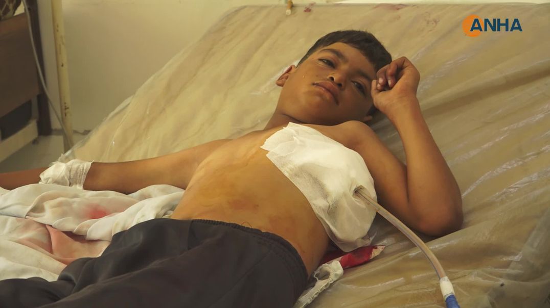 أم لطفل مصاب تسرد تفاصيل هجوم قوات حكومة دمشق على بلدتها