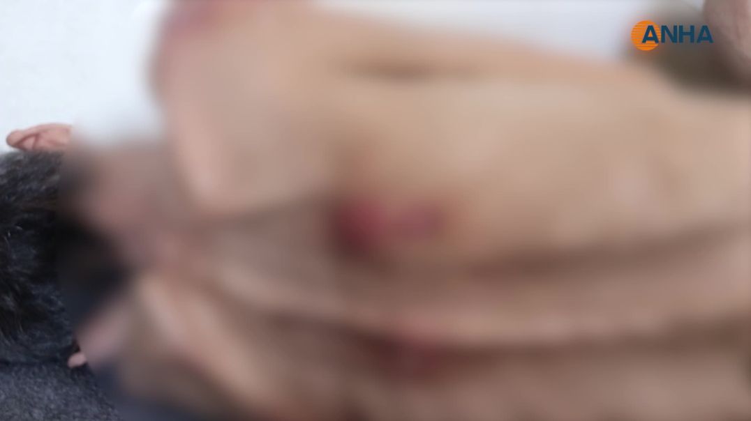 تدهور الحالة الصحية للمواطن (م ص) الذي عُذّب من قبل الاحتلال التركي