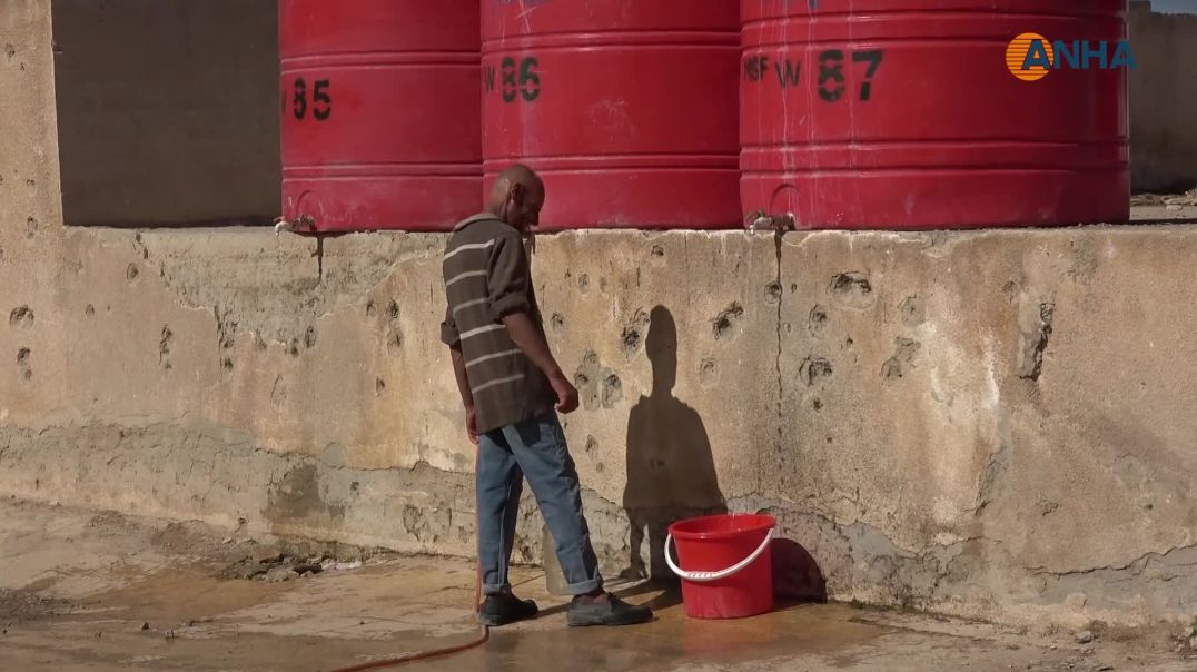 ⁣بعد فقدان ساقه وتهجيره مرتين حسين يعيش على أمل العودة